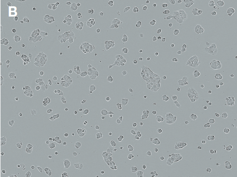 bright-field image demonstrating 35–40% transfection efficiency bright-field image demonstrating 35–40% transfection efficiency