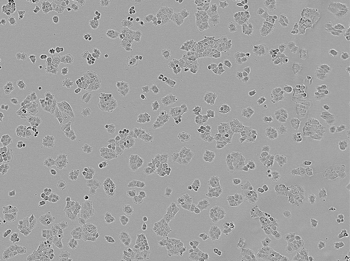 Brightfield image of NCI-H460 cells in culture, prior to transfection. Brightfield image of NCI-H460 cells in culture, prior to transfection.