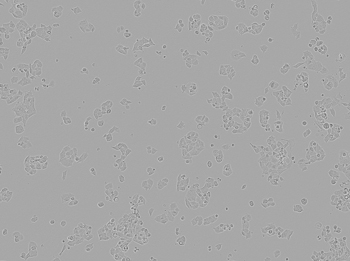 Brightfield image of NCI-H520 cells in culture, prior to transfection Brightfield image of NCI-H520 cells in culture, prior to transfection