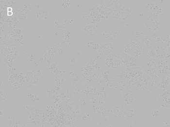 Posttransfection analysis of cells NCI-H520 bright-field image Posttransfection analysis of cells NCI-H520 bright-field image