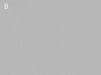 Posttransfection analysis of cells Posttransfection analysis of cells