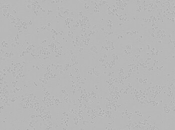 Brightfield image of SK-BR-3 cells in culture, prior to transfection Brightfield image of SK-BR-3 cells in culture, prior to transfection