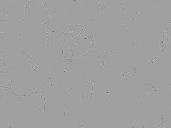 Brightfield image of V79 HG04 cells in culture prior to transfection Brightfield image of V79 HG04 cells in culture prior to transfection