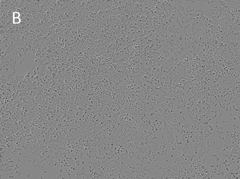 Posttransfection analysis of V79 HG04 cells bright-field images Posttransfection analysis of V79 HG04 cells bright-field images