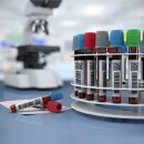 3个小时从采血到出报告 3个小时从采血到出报告