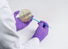 Next generation rapid culture media-based methods Next generation rapid culture media-based methods