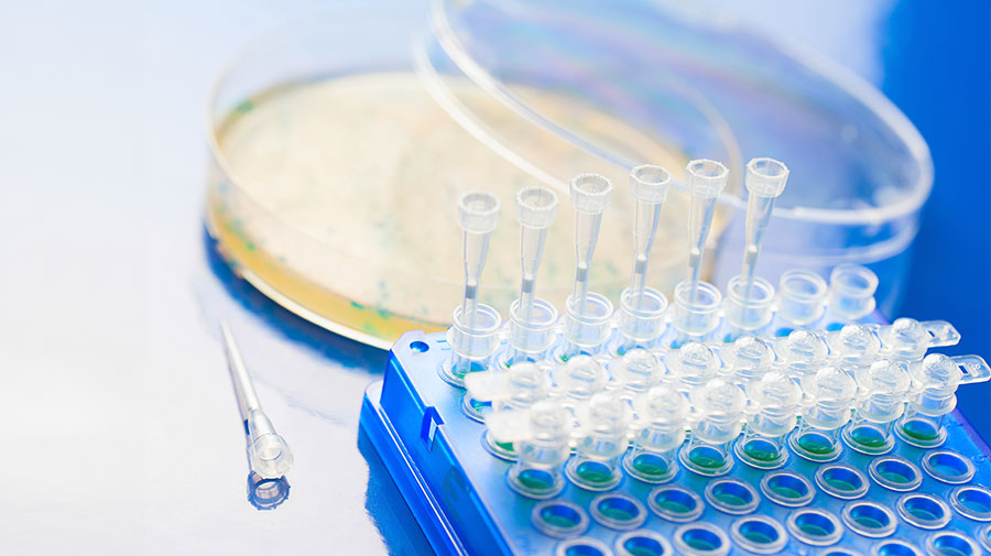 Colony PCR PCR tubes in blue holders, pipette tips, and petri plate with agar medium