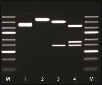 Plasmid DNA digestions Gel electrophoresis image with four lanes flanked by ladders. The gel bands have varying intensities.