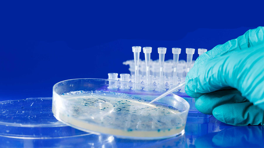 Selecting bacterial colonies a gloved hand picking blue bacterial colonies