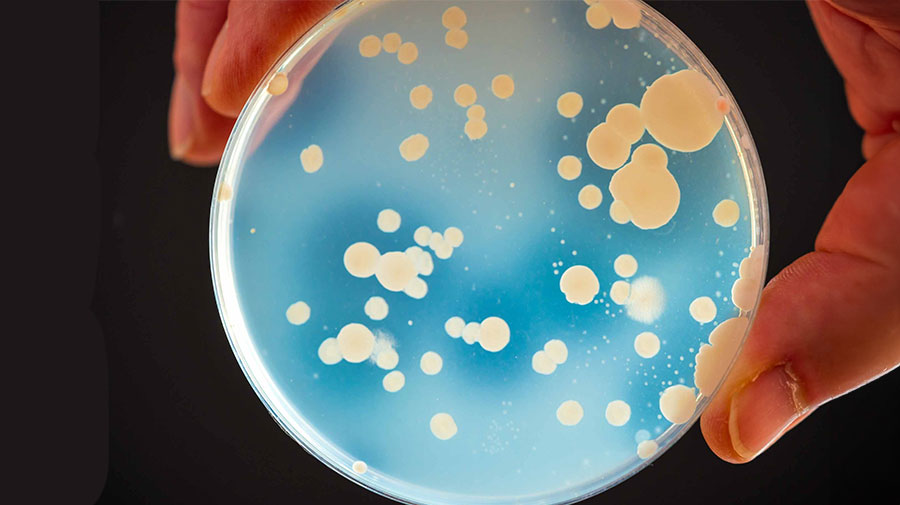 Bacterial colonies Decorative photo