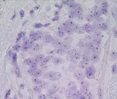 CISH Overview CISH Overview