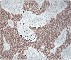Next Generation IHC Detection Kits Next Generation IHC Detection Kits