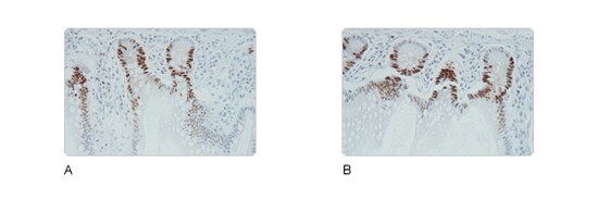 Increased stability Increased stability