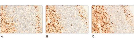 Increased user tolerance Increased user tolerance