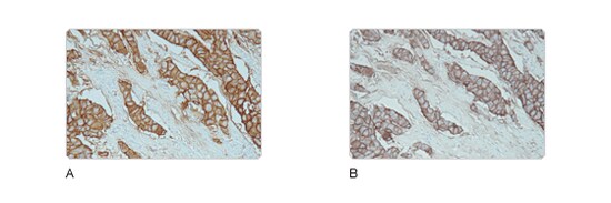 Increased sensitivity Increased sensitivity