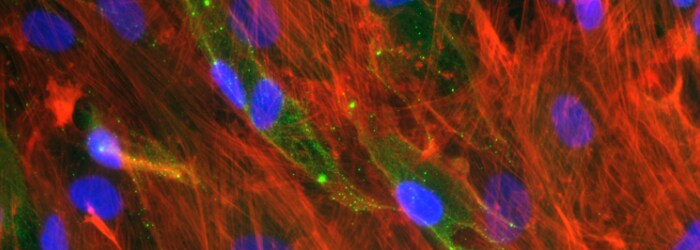 fluorescently stained cells Human mesenchymal stem cells cultured under osteogenic differentiation conditions, DAPI nuclear stain (Blue) primary osteocalcin antibody bound to secondary Alexa 488 antibody (Green); Phalloidin Alexa 594( Red) Magnification: 400X fluor