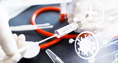 Article: How did the COVID-19 pandemic affect the spread of sexually transmitted infections? Close up of STI blood sample in collection tube