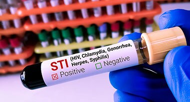 Serology (Blood) Collection tube with purple cap