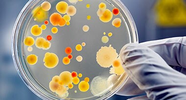 Culture Clear culture dish showing pathogens in medium