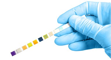 Urine test strips Decorative image showing gloved hand holding a urine test strip