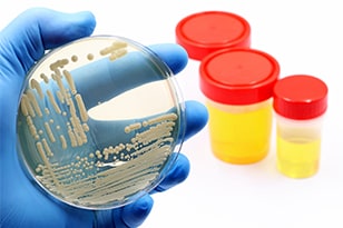 Culture of yeast Candida auris Image of microbiological culture of yeast Candida auris, responsible for urinary tract infections (UTIs)
