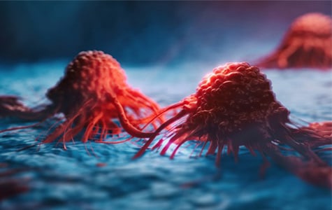 Virtual rendering of cancer cells Cancer cells that could be biopsied