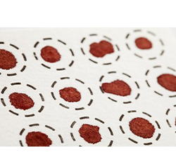 Dried blood spot and EDTA treated plasma image Dried blood spot and EDTA treated plasma image