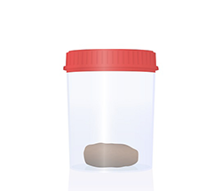 Swab and fecal cup image Swab and fecal cup image