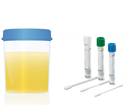 Swab and urinary cup image Swab and urinary cup image