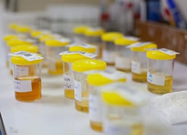 specimen-validity-testing-urine-cups specimen-validity-testing-urine-cups