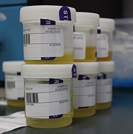 urine-drug-testing-urine-sample-cup urine-drug-testing-urine-sample-cup