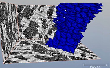 The area fraction of mitochondria vs total tissue The area fraction of mitochondria vs total tissue