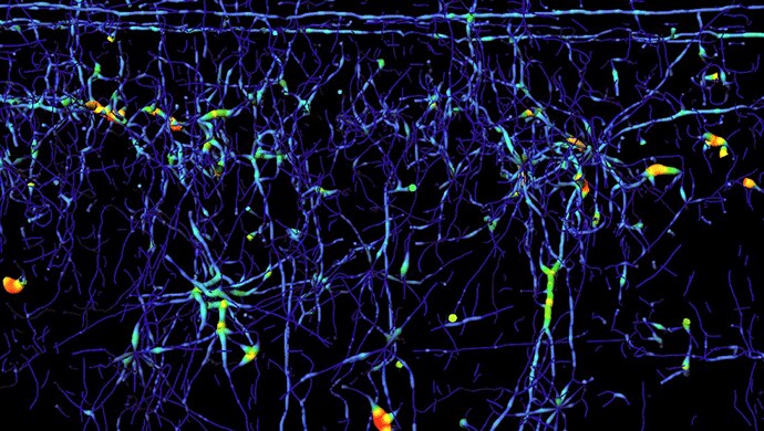 Tube rendering of traced axons colorized according to axon thickness. Tube rendering of traced axons colorized according to axon thickness.