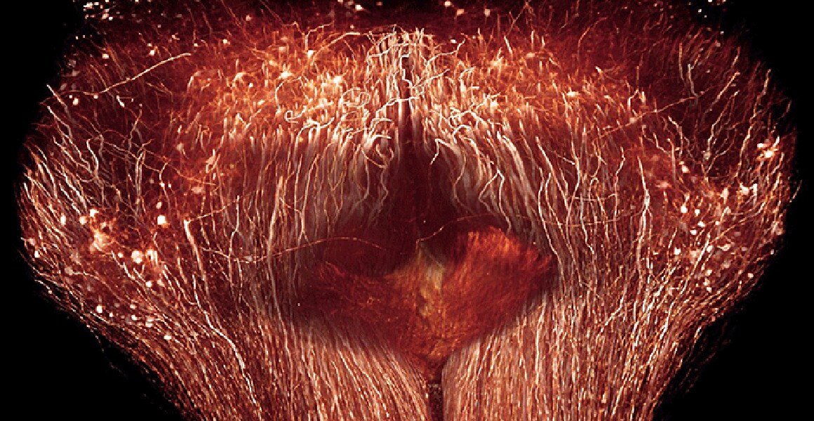 Volume rendering of cleared spinal cord as imaged with 2-photon microscopy Volume rendering of cleared spinal cord as imaged with 2-photon microscopy