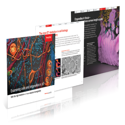 Cryo-Electron Tomography eBook Cryo-Electron Tomography eBook
