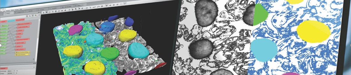Discover all recent evolutions of Avizo Software solutions Porosity and segmentation of popcorn. Images acquired with a FIB SEM