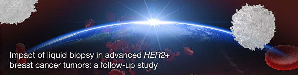 liquid-biopsy-webinar-breast-cancer-2 liquid-biopsy-webinar-breast-cancer-2