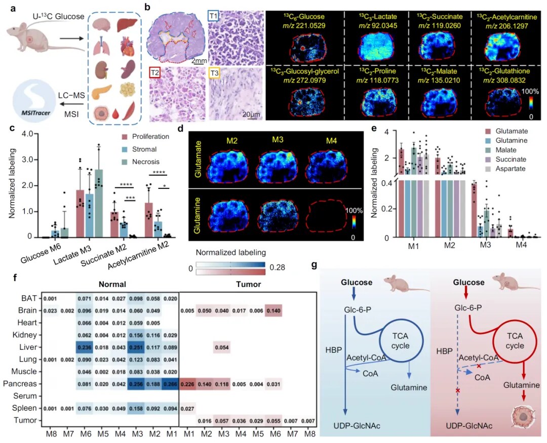 异种移植小鼠模型中肝癌引起的全身代谢改变 异种移植小鼠模型中肝癌引起的全身代谢改变