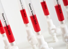 Troubleshoot common SPE issues Troubleshoot common SPE issues