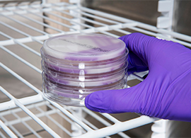 Coloring the path to food safety: streamlined chromogenic media workflows for high throughput labs Coloring the path to food safety: streamlined chromogenic media workflows for high throughput labs