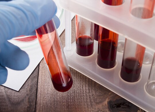 Forensic Blood Analysis Forensic Blood Analysis