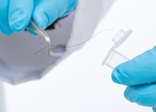 Forensic Hair Analysis Forensic Hair Analysis