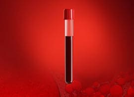 LC-MS Medical Devices for In Vitro Diagnostic Use LC-MS Medical Devices for In Vitro Diagnostic Use