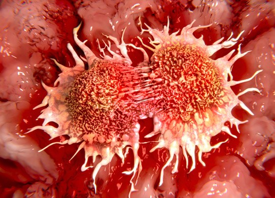 Cancer Metabolomics Cancer Metabolomics