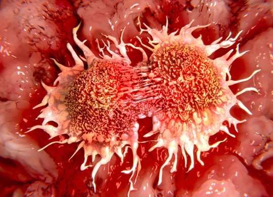 Cancer Metabolomics Cancer Metabolomics