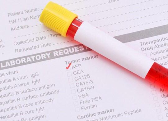 Biomarker discovery Biomarker discovery