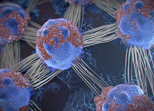 Cancer metabolism Cancer metabolism