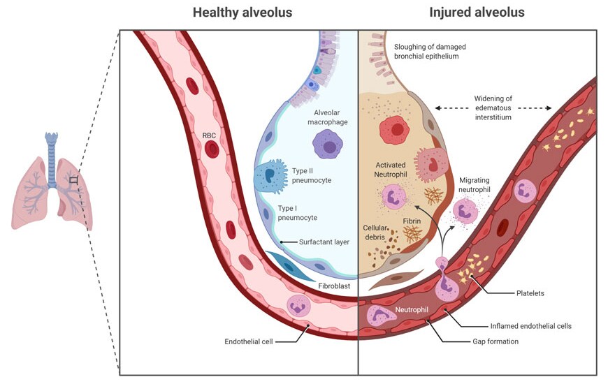 Translational research Translational research