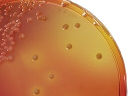 USP-60-Culture-Media-Burkholderia-cepacia-270x195px USP-60-Culture-Media-Burkholderia-cepacia-270x195px