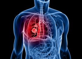 Cancer research Cancer Research Kinases